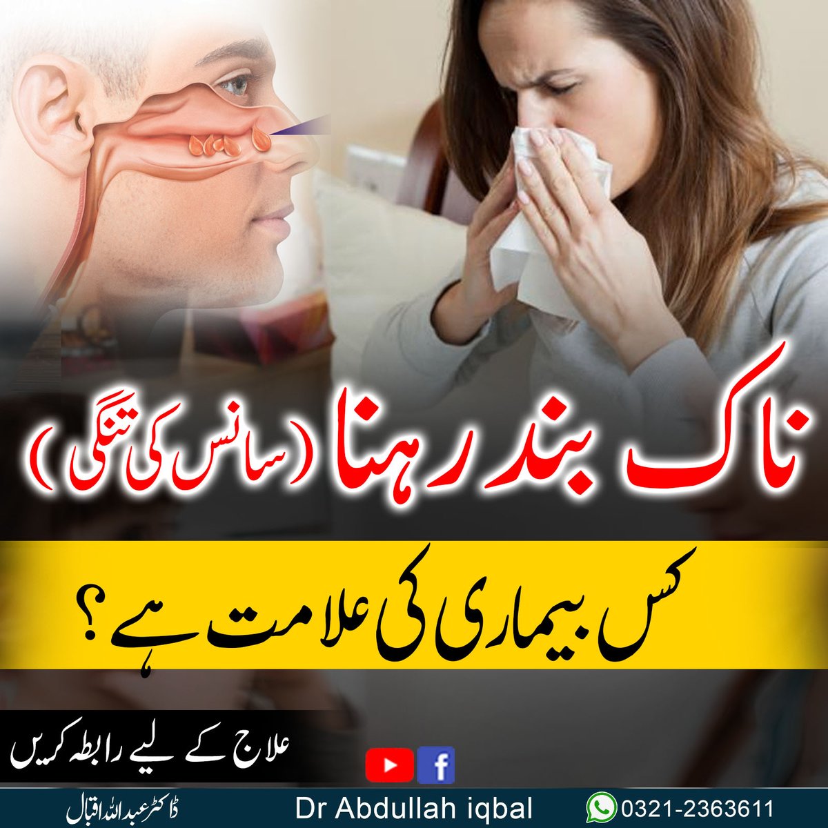 drabdulahiqbal's tweet photo. Nasal Polyps
#NasalPolyps
#NasalPolypsAwareness
#NasalPolypsSupport
#ChronicSinusitis
#ENT (Ear, Nose, and Throat)
#SinusProblems
#NasalHealth
#SinusSurgery
#NasalPolypsJourney
#NasalPolypsWarrior
#NasalPolypsTreatment
#NasalCongestion
#SinusIssues
#BreathingDifficulties https://t.co/8keG1X7gof