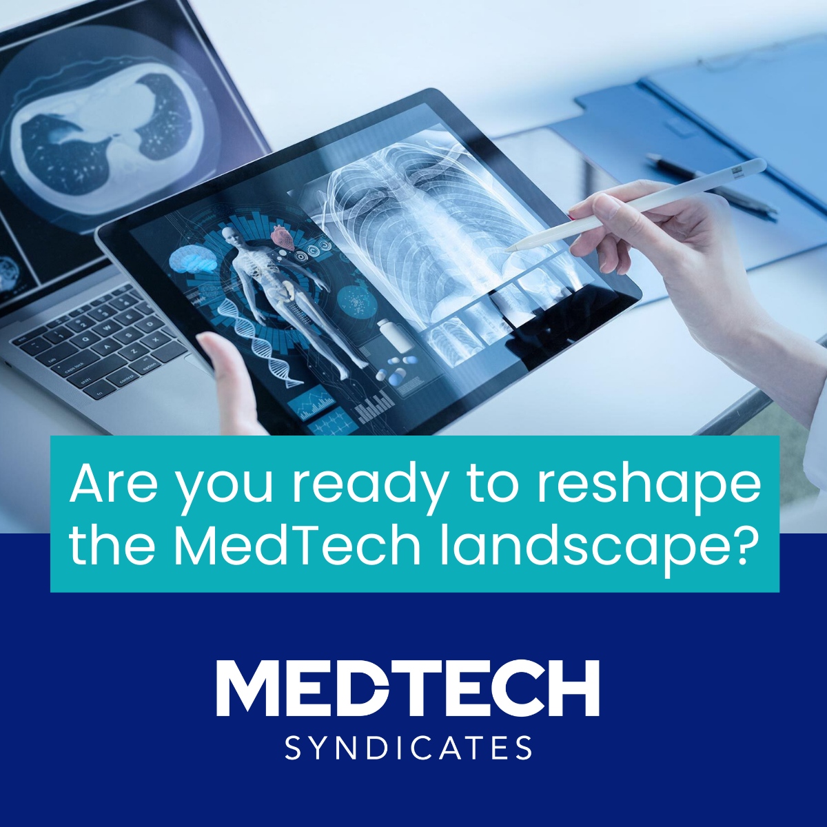 From medical devices to cutting-edge digital healthcare products, MedTech Syndicates champions a diverse range of solutions set to revolutionise the healthcare landscape. #MedTechSyndicates #SeedFundingJourney #MedTech #SeedFunding