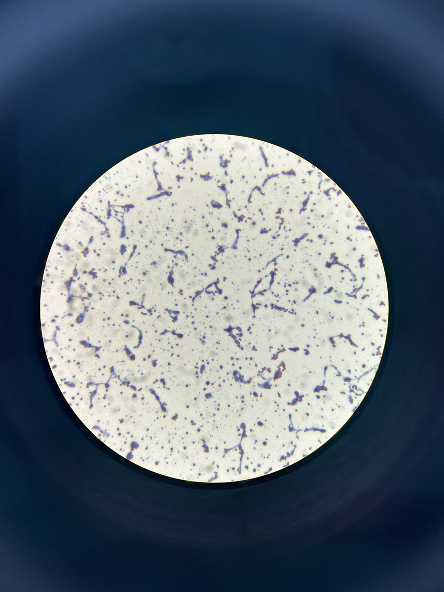 sophlb02's tweet photo. Some pretty images from cell staining this morning in infection sciences

It’s a shame the circles are slightly askew🔬

@UoWBioSci #UoWBioSci 🧫🧬👩🏼‍🔬 https://t.co/GmaNcgblBC