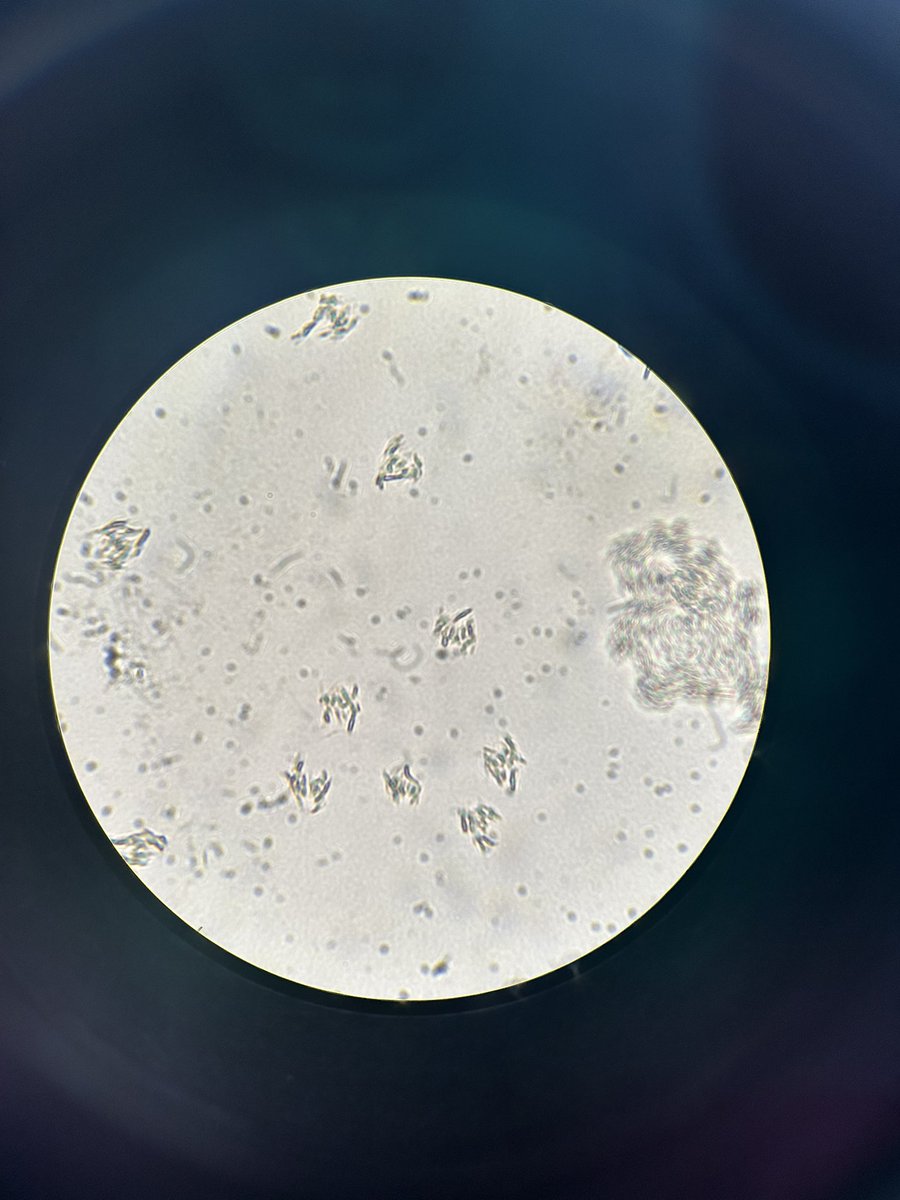 sophlb02's tweet photo. Some pretty images from cell staining this morning in infection sciences

It’s a shame the circles are slightly askew🔬

@UoWBioSci #UoWBioSci 🧫🧬👩🏼‍🔬 https://t.co/GmaNcgblBC
