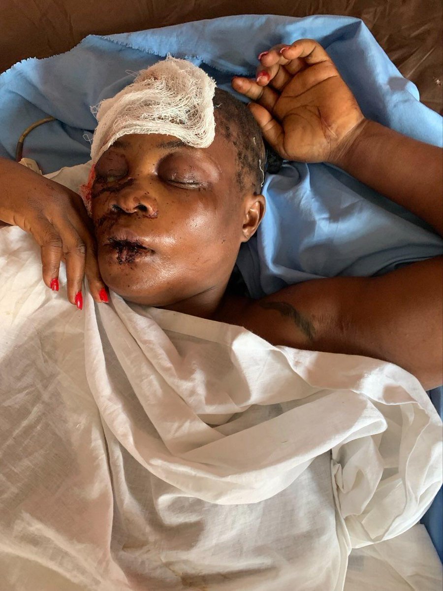 MyGbagada's tweet image. OKORIE DEBORAH ONYINYECHI of Enugu was involved in an accident Saturday evening, October 14th, 2023 on Gbagada Expressway.

She is presently receiving treatment at Burns &amp;amp; Trauma centre of Gbagada General hospital in Lagos.

Please repost till her family sees this

@Gidi_Traffic