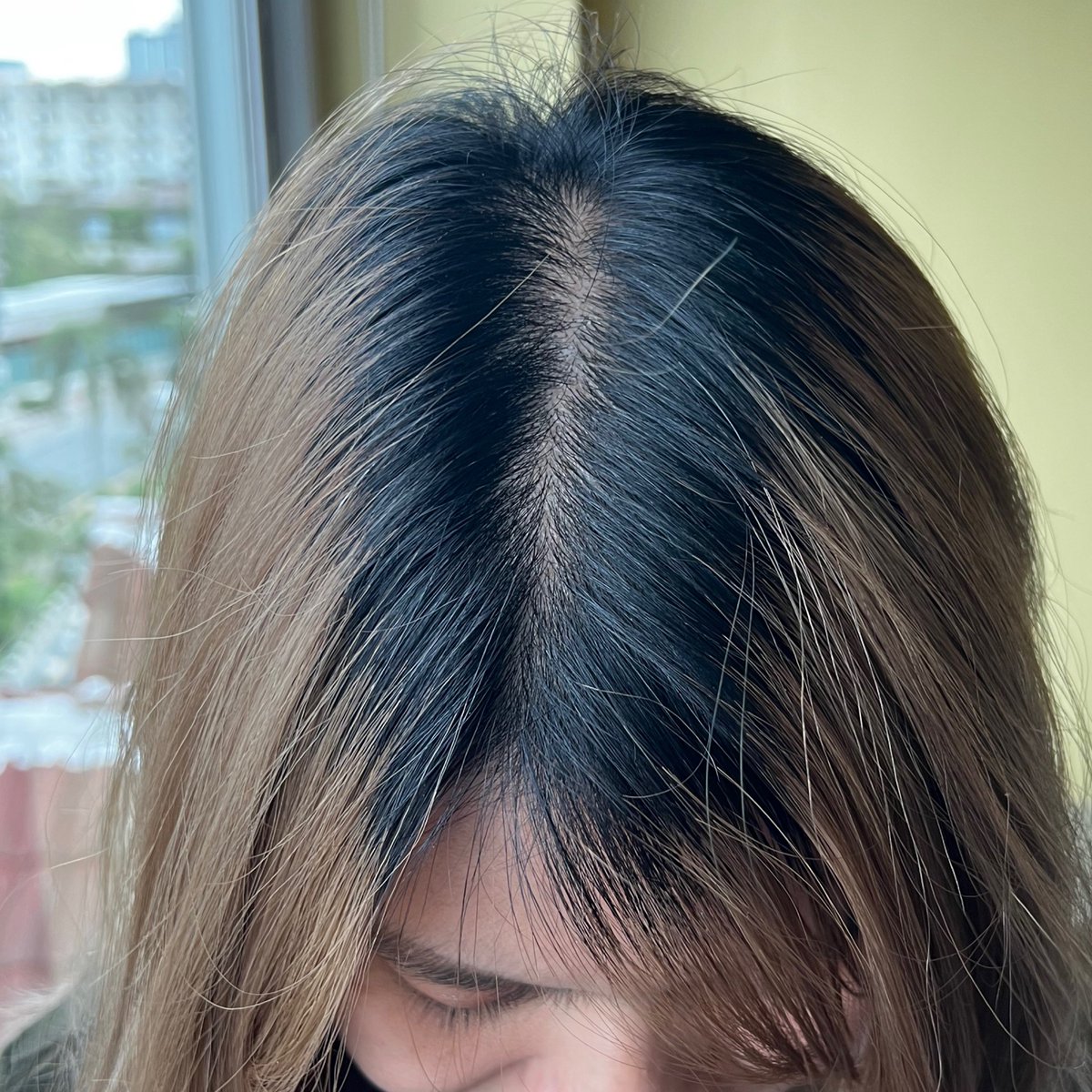 reviewstylegg's tweet photo. ใครทำสีผมเก่งแบบเรา แล้วผมร่วงหนักหน่วง ยับเยิน มาฟังทางนี้จ้า ต้องขยันหมักบำรุงให้ผมกลับคืนมา ผลลัพธ์คุ้มค่ากับที่เราตั้งใจทำสม่ำเสมอ สังเกตุได้จากไรผมลูกผมมาเต็ม รอยแสกจากกว้างๆเริ่มกลับมาแคบเหมือนเดิมแล้ว เอางี้ ตอนนี้ผมร่วงยากขึ้น-แทบไม่ร่วงละ แต่เงินในกระเป๋ายังร่วงยังรั่วอยู่เรื่อยๆ😆
