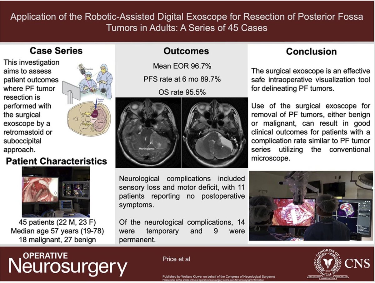 Neurosurgery Publications (@neurosurgerycns) on Twitter photo #ONSVisualAbstract Application of the Robotic-Assisted Digital Exoscope for Resection of Posterior Fossa Tumors in Adults: A Series of 45 Cases bit.ly/3tGOLE4 by Price et al <a href="/MountSinaiNYC/">Mount Sinai Health System</a> <a href="/WannaGeorge/">George Wanna</a> <a href="/hadjiMDPhD/">Costas Hadjipanayis</a> <a href="/IsaacYangMD/">Isaac Yang MD</a> <a href="/e_celano/">Emma Celano</a> #Exoscope #Posteriorfossatumors #ONSVisualAbstract Application of the Robotic-Assisted Digital Exoscope for Resection of Posterior Fossa Tumors in Adults: A Series of 45 Cases bit.ly/3tGOLE4 by Price et al <a href="/MountSinaiNYC/">Mount Sinai Health System</a> <a href="/WannaGeorge/">George Wanna</a> <a href="/hadjiMDPhD/">Costas Hadjipanayis</a> <a href="/IsaacYangMD/">Isaac Yang MD</a> <a href="/e_celano/">Emma Celano</a> #Exoscope #Posteriorfossatumors