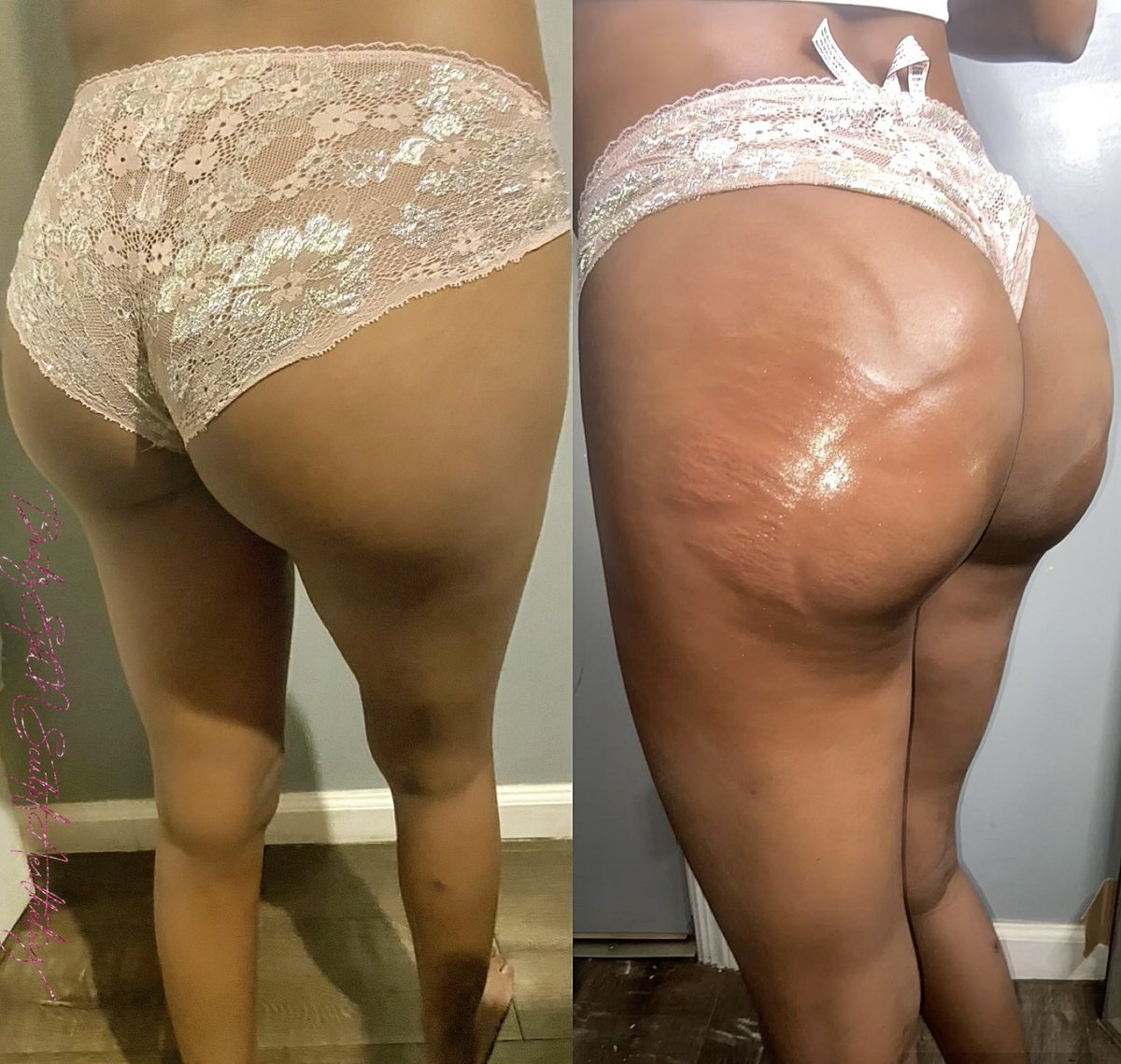 5starBarbx's tweet photo. 4 Area Vaccum Therapy Butt lift 💕 
Client: 1/8 sessions in , 8 sessions required for Ultimate results!
Book : Bratz Spa N Sculpt
Traveling Aesthetician 🚫💉 https://t.co/uTZEES0bjf