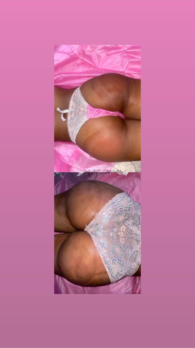 5starBarbx's tweet photo. 4 Area Vaccum Therapy Butt lift 💕 
Client: 1/8 sessions in , 8 sessions required for Ultimate results!
Book : Bratz Spa N Sculpt
Traveling Aesthetician 🚫💉 https://t.co/uTZEES0bjf