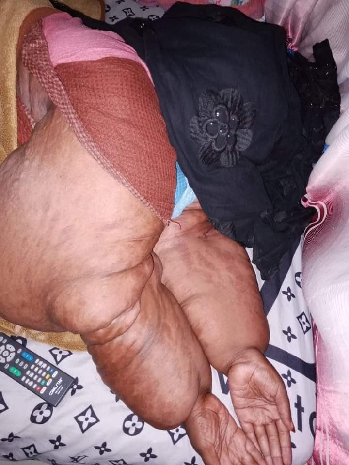 Makhfouss2's tweet photo. 🚨URGENCE🚨
Sokhna doit faire une opération plus rééducation au Maroc en Urgence mais n’a pas les moyen. Elle est très très fatigué et nous comptons sur vous pour sauvez la vie de cette femme.

La collecte est à 421.000 F
Objectif : 15 millions

Orange Money / Wave : 77 795 27 42 https://t.co/ajXCr6IaWv