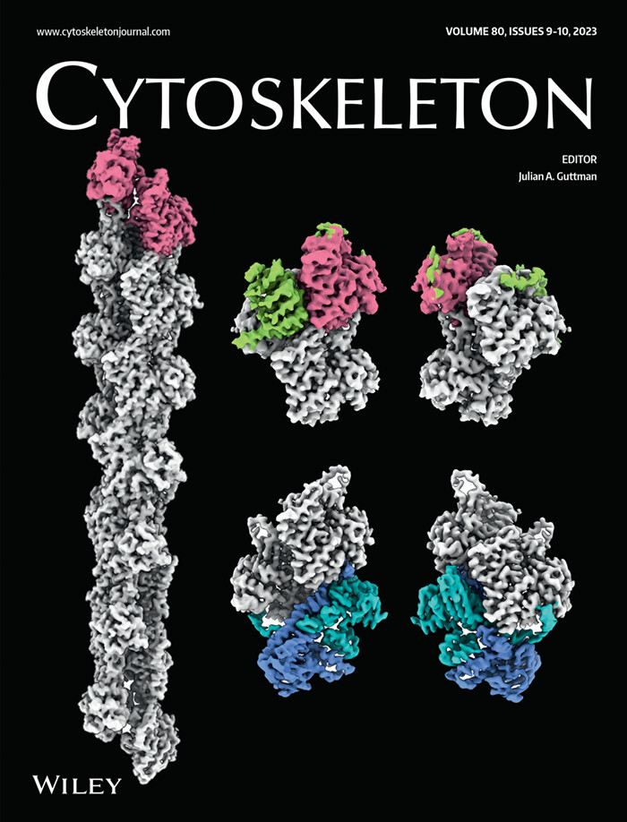 CytoskelJournal's tweet photo. The new issue of CYTOSKELETON @CytoskelJournal is out with the front cover from Roberto Dominguez, Kyle R. Barrie and Peter J. Carman. Have a look at the issue here https://t.co/dNrL8vh15k #actin #capZ #cytoskeleton #research #cell #cellbiology #microtubule #tropomodulin https://t.co/RGNf2wSLQX