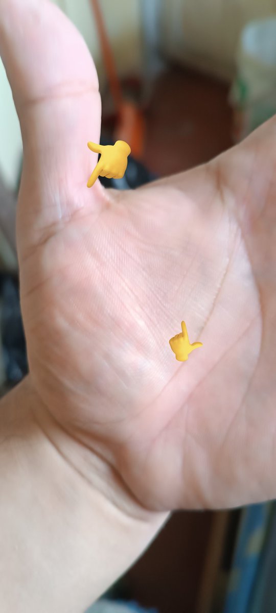 Hace unos días me lesione el pulgar 😅, les muestro un poco de como quedó aún aún tengo dolor en ciertos lados del dedo, lo que es volver a jugar fútbol, creo que mejor digo en el Pokémon unite 😅