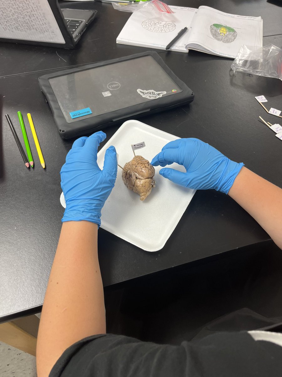 MFMSPride's tweet photo. "🧠🐑 Mrs. Neve's class is diving into the fascinating world of brain science! 📚🔬 They're exploring the structure and function of the brain and its parts using a real sheep brain. 🐏🧠 Learning can be so hands-on and exciting! 🌟 #BrainExploration #HandsOnLearning" https://t.co/vSeh12yM6p