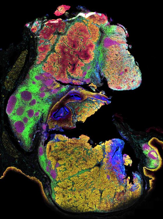 AkoyaBio's tweet photo. 🔥 Hot off the press! Researchers from #AkoyaBio &amp; @UQ_News's Frazer Institute have comprehensively mapped the spatial proteome of #headandneck squamous cell carcinoma using ultrahigh-plex #spatialphenotyping w/ #PhenoCyclerFusion. https://t.co/gCX6QKQW3m

@GENbio @aruthak https://t.co/4XNMdxAFUO