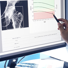 Dr Samvelyan has been awarded a grant from UKRI to explore the fascinating connection between our endocrine system, physical activity, and bone health.

Learn more here: aru.ac.uk/news/study-to-…

#ARUResearch #HealthAndWellness