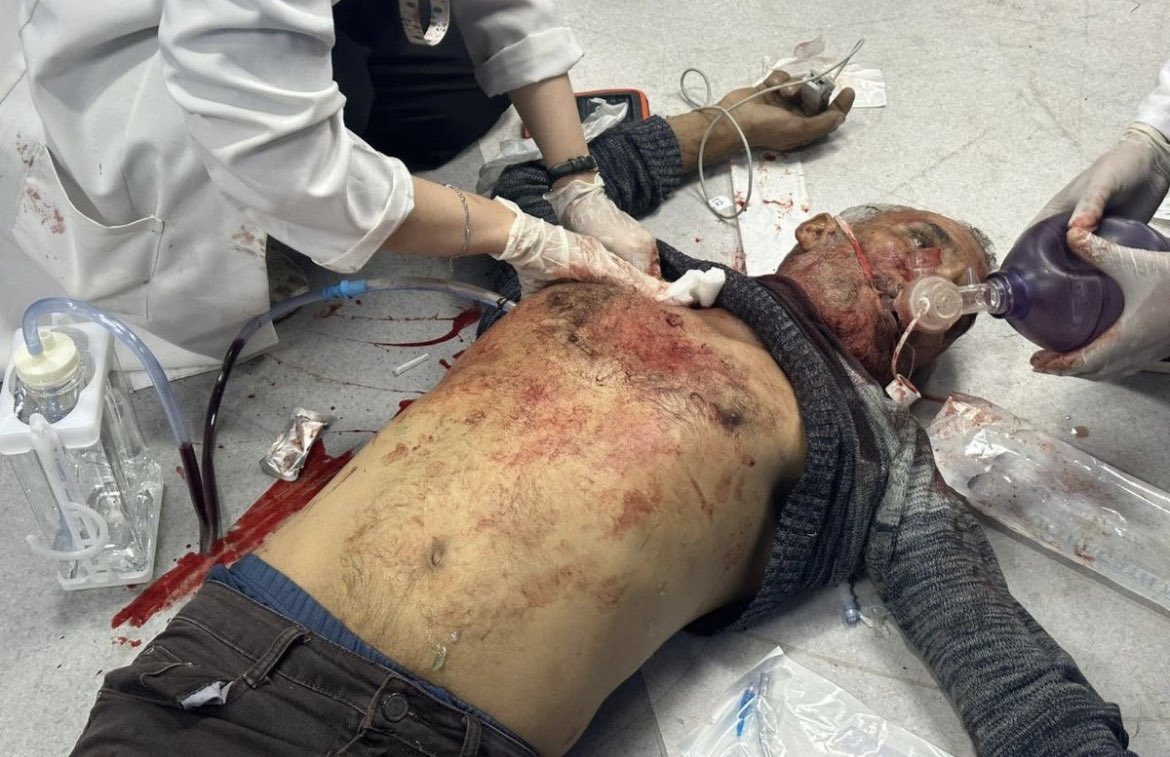 Israel kills 900 wounded Palestinians in a hospital, including children and women,one of the most horrific war crimes in history.Blood stains the face of humanity and mankind.A crime borne by every silent supporter of Israeli terrorism
#Netanyahu_A_criminal_of_war 
#Gazagenocide