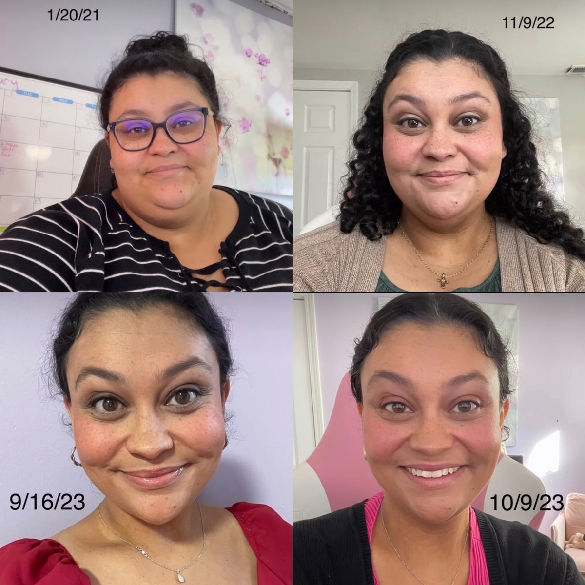 #barituesday = #transformationtuesday @advbariatrics is 💕 this #facetoface #vsgtransformation from @christianaolvera She is #unrecognizable & in a good way 😉 #gettinghealthy #looksgoodonyou #thiscouldbeyou DM us to start your #wlsjourney #teamcheregi #bariatricbabes #powerofshe