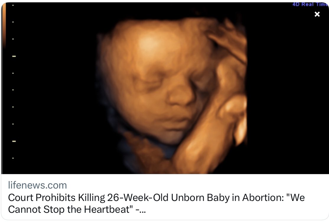 #SaveTheBabyHumans 

Supreme Court of India Prohibits Killing 26-Week-Old Unborn Baby in Abortion: “We Cannot Stop the Heartbeat”

lifenews.com/2023/10/16/cou…