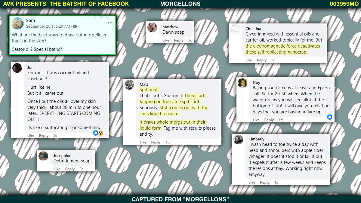 VaxxersAnti's tweet image. Huzzah! Huzzah, I say!  

The cure for Morgellons has been found and it looks like it might be as easy as washing yourself on occasion.

Failing that, you can always try electromagnetic glycerin, vinegar showers or just a big, fat loogie.

#Morgellons