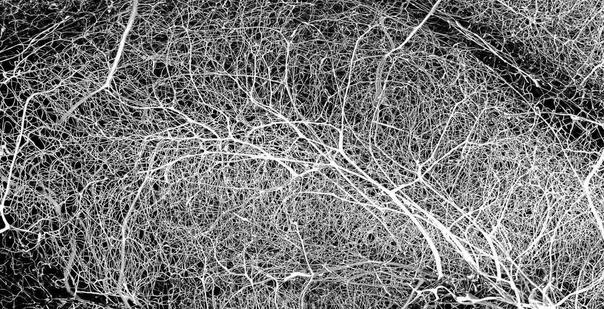 Tedeschi Sun LAB (@tedsunl) on Twitter photo Excited to share @#osu_neuro #OhioStateMed #OSUWexMed #OhioStateCBI graduate student Stephen Vidman’s <a href="/NikonSmallWorld/">Nikon Small World</a> image (hippocampal vascular network) of distinction. Check the beautiful winning imagery of the 2023 competition Excited to share @#osu_neuro #OhioStateMed #OSUWexMed #OhioStateCBI graduate student Stephen Vidman’s <a href="/NikonSmallWorld/">Nikon Small World</a> image (hippocampal vascular network) of distinction. Check the beautiful winning imagery of the 2023 competition