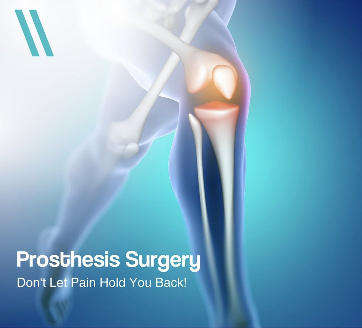 Dr_Rashidd's tweet image. Life is too short to be held back by hip,  knee, or shoulder pain. If you&apos;ve been struggling with movement and daily activities, it&apos;s time to consider Prosthesis Surgery.

Prosthesis Surgery is a surgical procedure where damaged joints like the knee, hip, or shoulder are replaced…