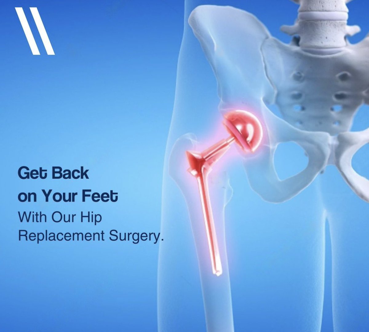 Dr_Rashidd's tweet image. Life is too short to be held back by hip,  knee, or shoulder pain. If you&apos;ve been struggling with movement and daily activities, it&apos;s time to consider Prosthesis Surgery.

Prosthesis Surgery is a surgical procedure where damaged joints like the knee, hip, or shoulder are replaced…