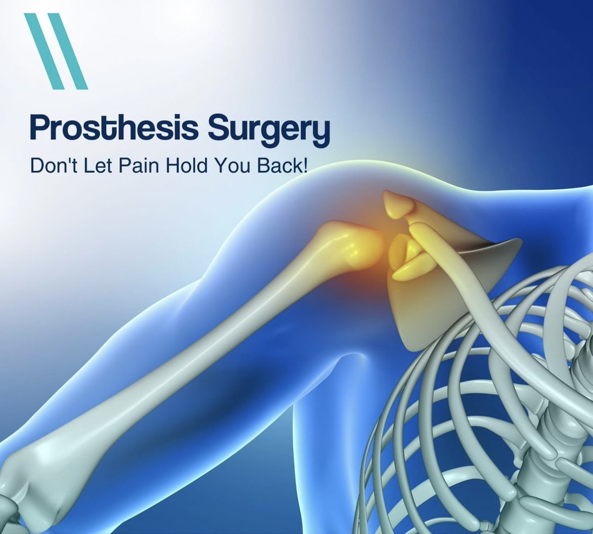Dr_Rashidd's tweet image. Life is too short to be held back by hip,  knee, or shoulder pain. If you&apos;ve been struggling with movement and daily activities, it&apos;s time to consider Prosthesis Surgery.

Prosthesis Surgery is a surgical procedure where damaged joints like the knee, hip, or shoulder are replaced…