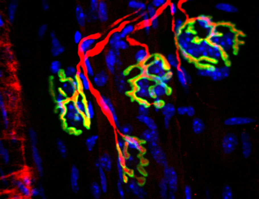 New research identifies 15-PGDH as a “gerozyme” linked to muscle wasting and #denervation during aging and after nerve trauma—and shows that 15-PGDH inhibitors halt muscle denervation in aged mice and rodents with nerve crush injuries. @stanfordimmuno scim.ag/4uA