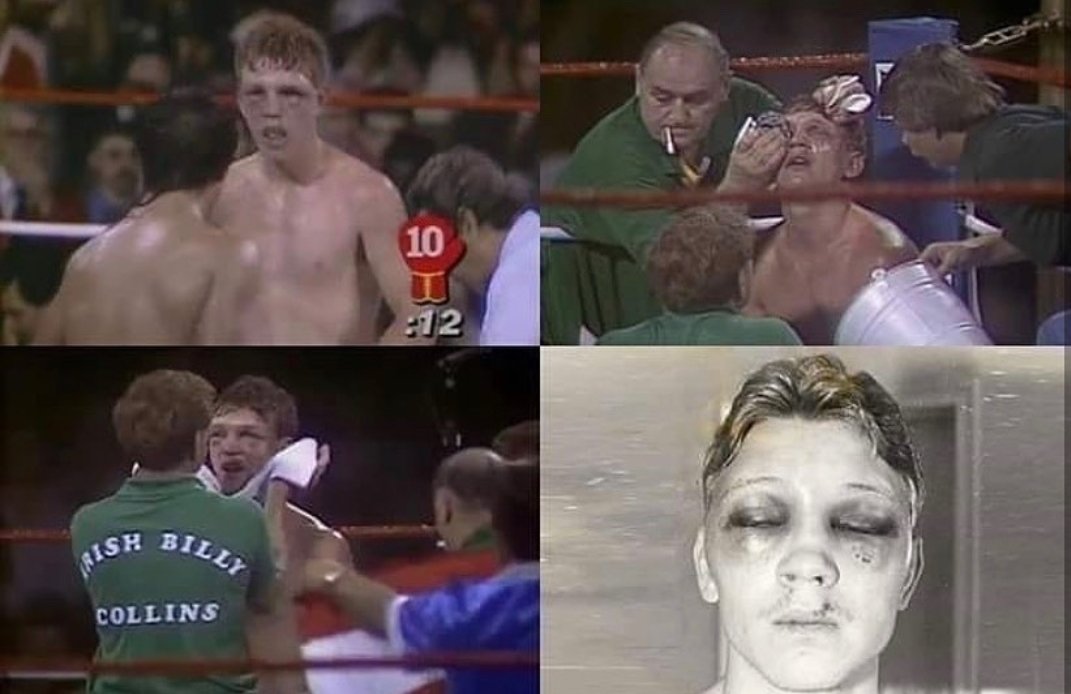 MANO DE YESO

La pelea de 1983 entre el boxeador puertorriqueño Luis Resto y el estadounidense Billy Collins Jr. no fue una mas. Será recordada como la página mas negra de la historia del boxeo. Luego de esta pelea, por distintas razones ninguno de los dos volvió a subirse a un