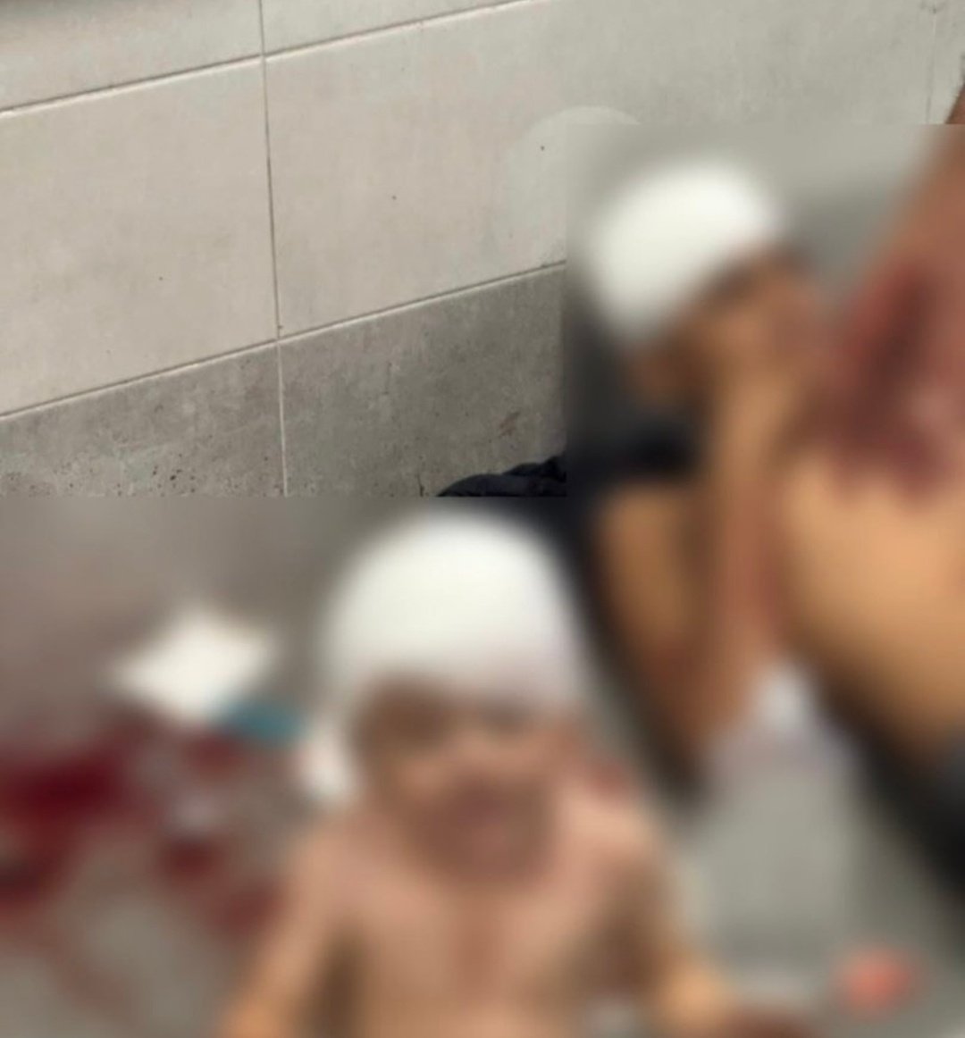 BTS_EGYPT_EAGLE's tweet photo. 🚫

Israel just BOMBED one of biggest hospital in Gaza, killing over now more than 1000 civilians.
IS THERE ANY CREATURE STILL SUPPORT ISREAL??? 
WHO STILL SUPPORT HOPE YOU SEE WORSE IN YOUR LIFE.

#طوفان_القدس #PalestineGenocide #GazaCity #Gaza #Gaza_under_attac https://t.co/26LtD1sLzx