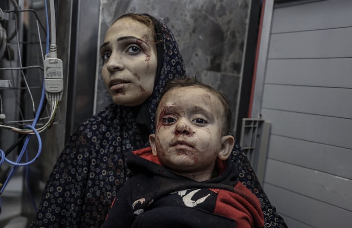 #Gaza_under_attack #IsraelTerorrist
رحم الله موتانا،احداث تهلك النفس القاعدين نشاهدة كل يوم ونوقف عاجزين عن فعل شيء الواحد ماله الا يدعي ربه ويترجاه