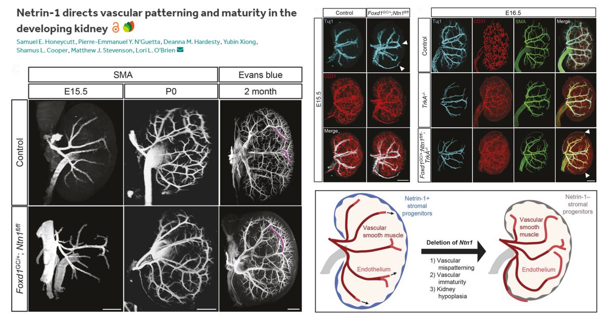 Hao Yin (@haoyin20) on Twitter photo FoxD1+ stromal progenitor Netrin 1 controls #Nephrogenesis & Arterial #BranchingMorphogenesis in developing kidney
Not phenocopied by Unc5c/Ntn3 KO
Arterial morpho-defects diminish in adult🐭, but +#VascularPermeability
<a href="/l_obrien_lab/">Lori O'Brien</a> <a href="/Dev_journal/">Development</a> 2023
journals.biologists.com/dev/article/do… FoxD1+ stromal progenitor Netrin 1 controls #Nephrogenesis & Arterial #BranchingMorphogenesis in developing kidney
Not phenocopied by Unc5c/Ntn3 KO
Arterial morpho-defects diminish in adult🐭, but +#VascularPermeability
<a href="/l_obrien_lab/">Lori O'Brien</a> <a href="/Dev_journal/">Development</a> 2023
journals.biologists.com/dev/article/do…