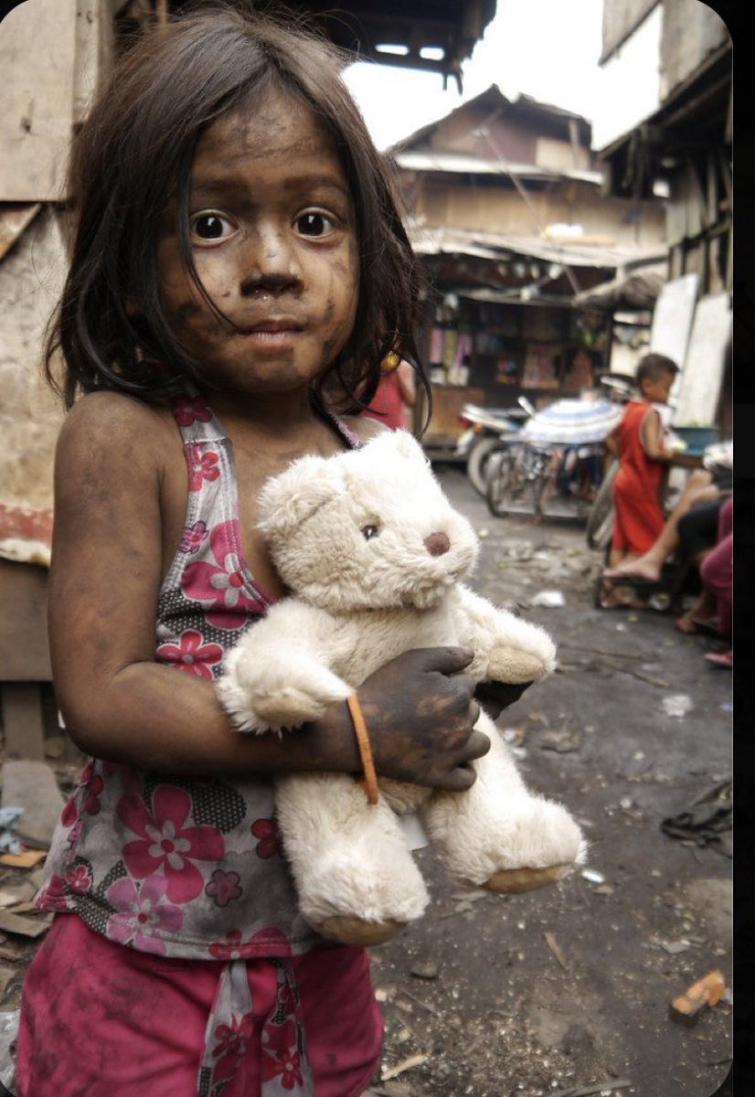 Yine dünyanın gözü önünde suç işledi. Savaş suçu falan değil bu, savaşın kuralı, savaşçının onuru olur. Bu düpedüz terördür.

Yakılmış, parçalanmış minik bedenler!   Onlar siyonist israil'in katliamından payını alan (!) çocuklar!#SavasaHayır