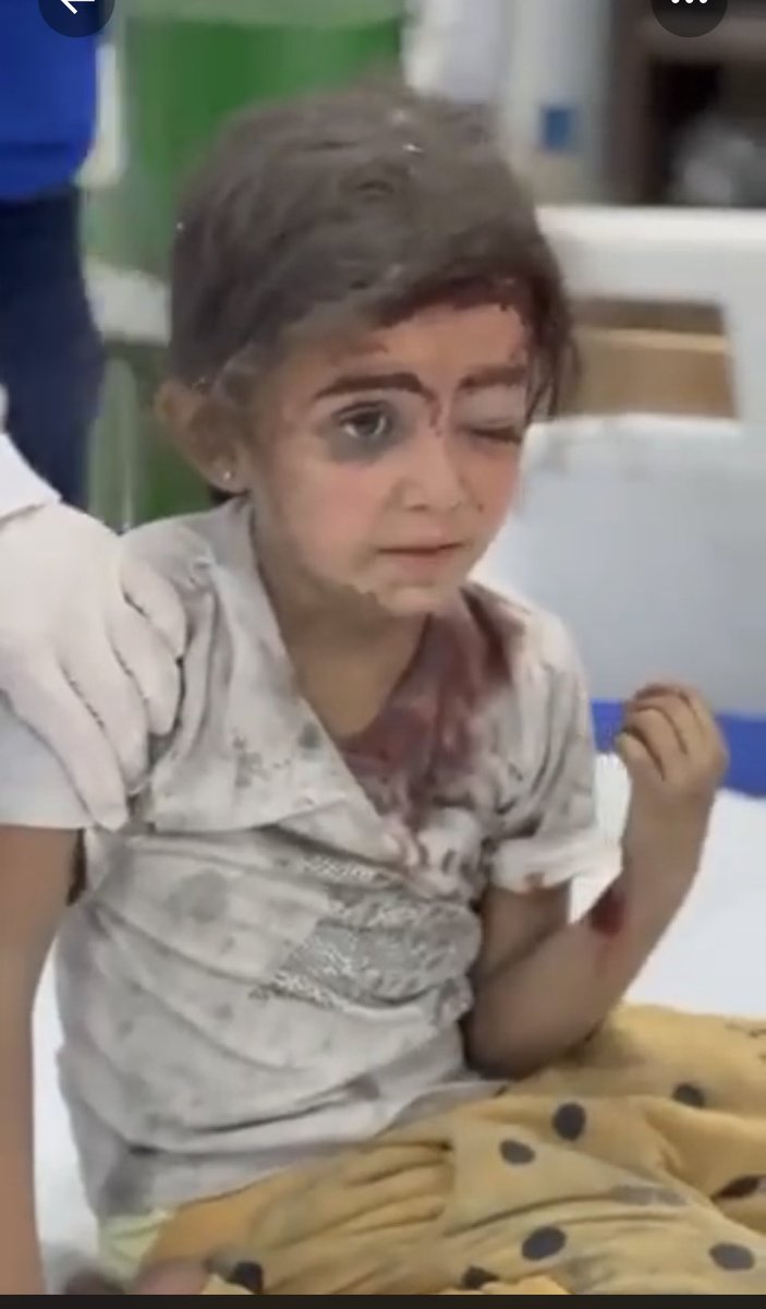 Allah’ım
Milyonlarca müslüman kör,sağır,dilsiz oldu;savunmasız sabiler,gençler,kadınlar katil İsrail tarafından katlediyor.Hastaneler bile bombalanırken eli kolu bağlı olarak bu vahşete şahit olmak insanı kahrediyor.
Sen yardım et Allah’ım.
#Katilİsrail