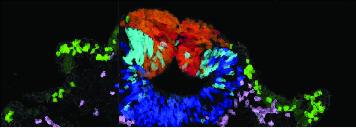 Our paper that challenges #gastrulation by showing #pluripotency signature in the entire #ectoderm as bases for #neuralcrest stem cell potential formation was chosen to the editor's highlights at @NatureComms / stem cells. Very proud of the whole team! nature.com/ncomms/editors…