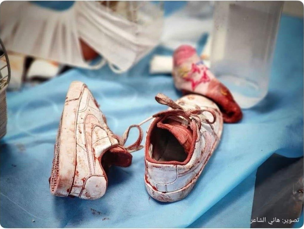 Hastane bombalayacak kadar gözleri kana bulanmış, zerre insanlıktan nasibini almamış ey caniler!
Günü geldiğinde sizi gargat ağacı bile kurtaramayacak..
Ancak, sözde Müslüman ülkeleri, sessiz kalanlar, kafasını kuma gömenler❗️
Vallahi sizide gargat ağacı bile kurtaramıyacak❗️