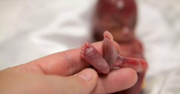 nanyzquivel's tweet image. Como le llaman los pro aborto a un ser humano (feto) que esta completamente formado de 12 semanas?  12 semanas de gestación es lo permitido según la ley,
Los dedos de manos y pies están separados unos de otros y tienen movimiento. Esto no es matar? El fin justifica los medios???