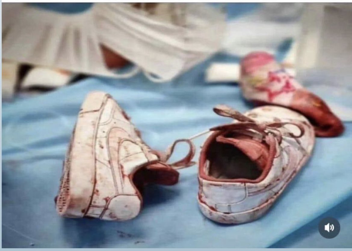 SBusraAkgun's tweet photo. Yine “insan”lıktan utandığım bir görüntü. 
Yine şairin de söylediği gibi, etimle kemiğimle bu çağdan nefret ettiğim günler. 

Neyin derdi, 
Neyin savaşı, 
Neyin düşmanlığı,
Neyin kini bu? 

#StopTheWar 
#StopGenocide 
#Stop https://t.co/BRNnvVTY0r