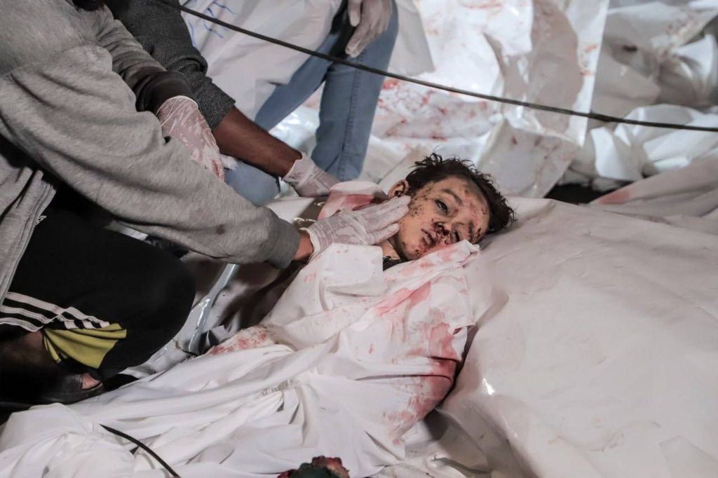 cintagaza_my's tweet photo. 600 syahid dan 900 cedera dalam pengeboman pesawat rejim Zionis di Hospital Al Ahli Al Ma’madani di Gaza, yang merupakan hospital yang bergabung dengan komuniti Kristian. Semua yang syahid dan cedera adalah orang awam, kebanyakannya kanak-kanak dan wanita. 

Sumber: Gaza Now https://t.co/eh6eURJ652