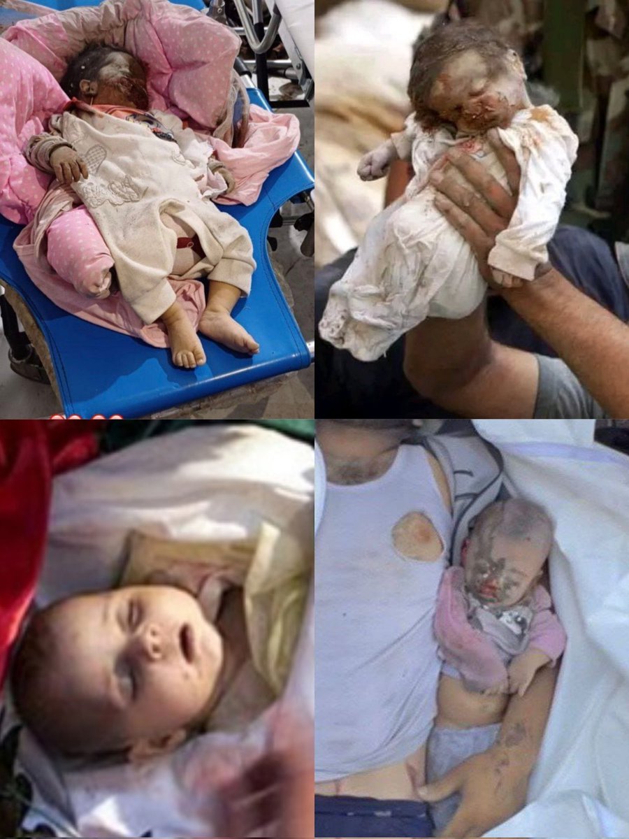 hcdal_91's tweet photo. Yes, be disturbed because this picture is real and don't be silent.
#PalestineGenocide 
#hospital 
#NetanyahuWarCriminal 
#babykiller https://t.co/qFoPwnptSg