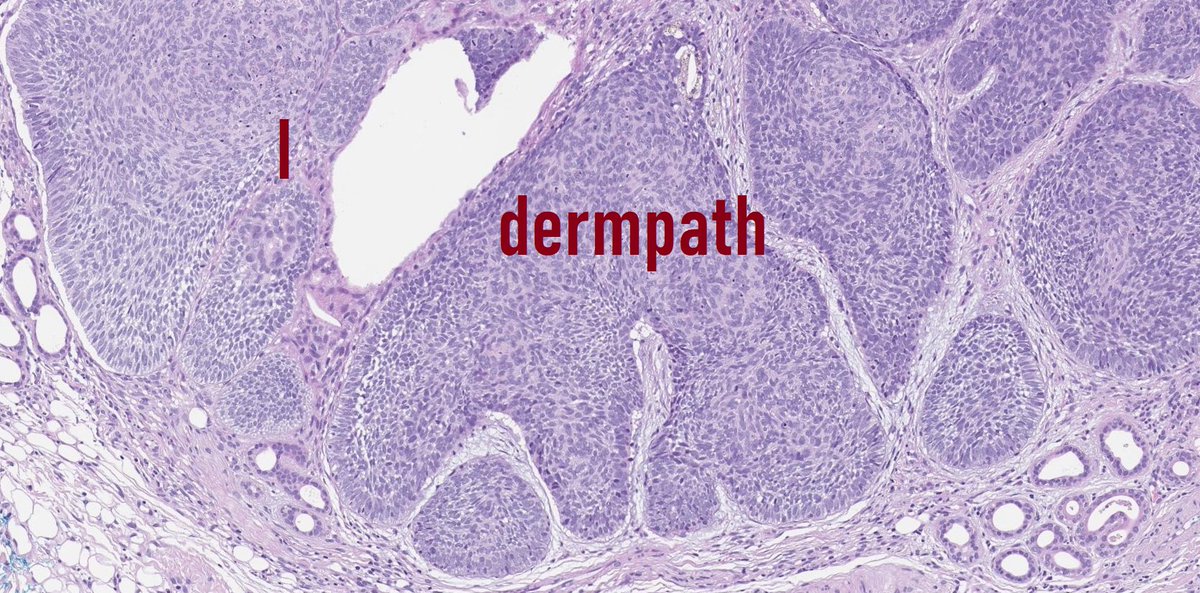 Romanow_MD's tweet photo. He-he let it be here =)
#PathTwitter #Dermtwitter #dermpath #pathart #Pathmeme https://t.co/teUzq1hZcL