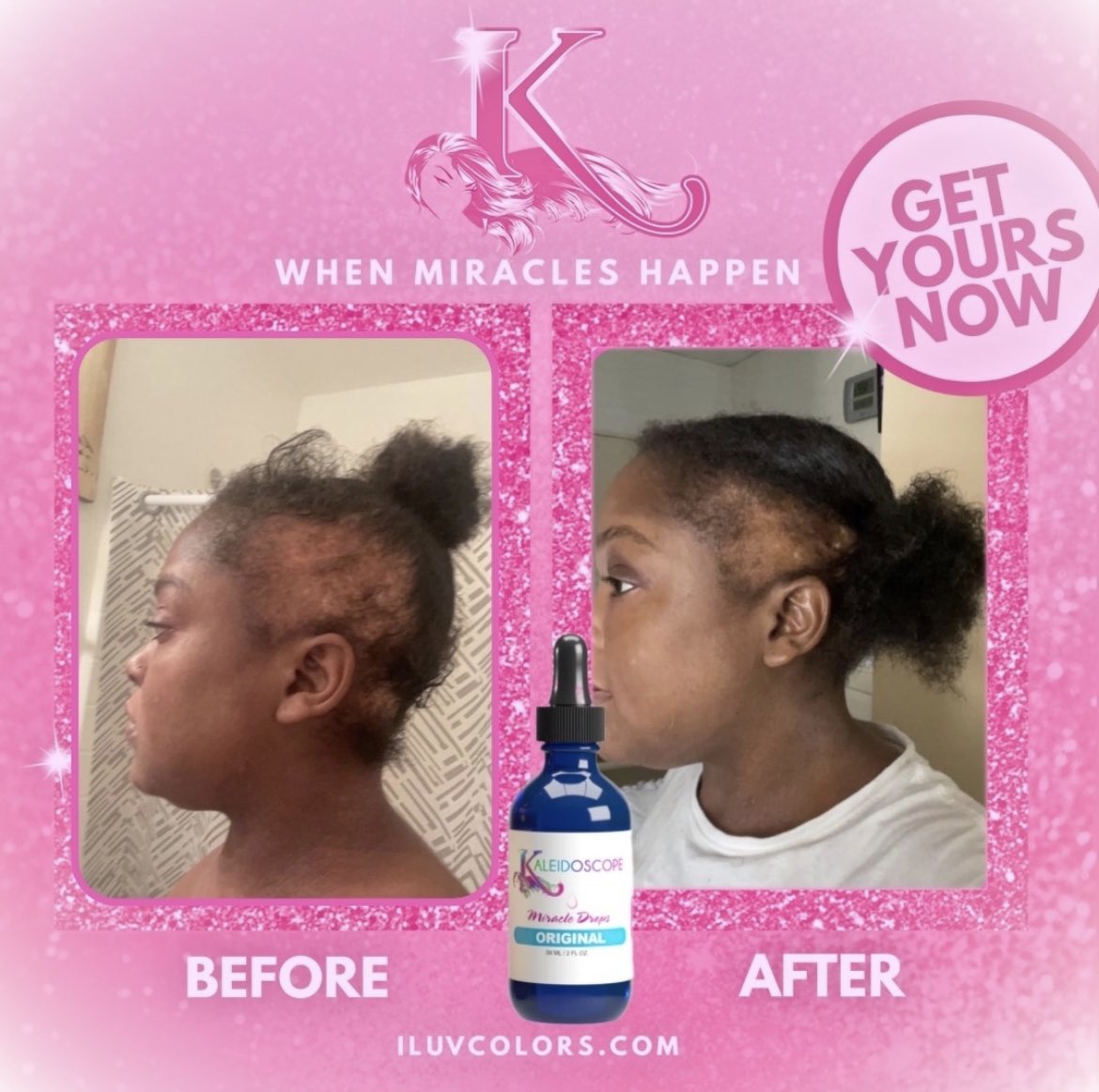 kaleidokrewe's tweet photo. DASS RIGHT JADA ππ½ She said what she saidβΌοΈπ when we say everyone we mean EVERYONE! Grab yours today at https://t.co/CqgauIhTHa #miracledrops #JadaPinkettSmith https://t.co/9e74sGVHPP