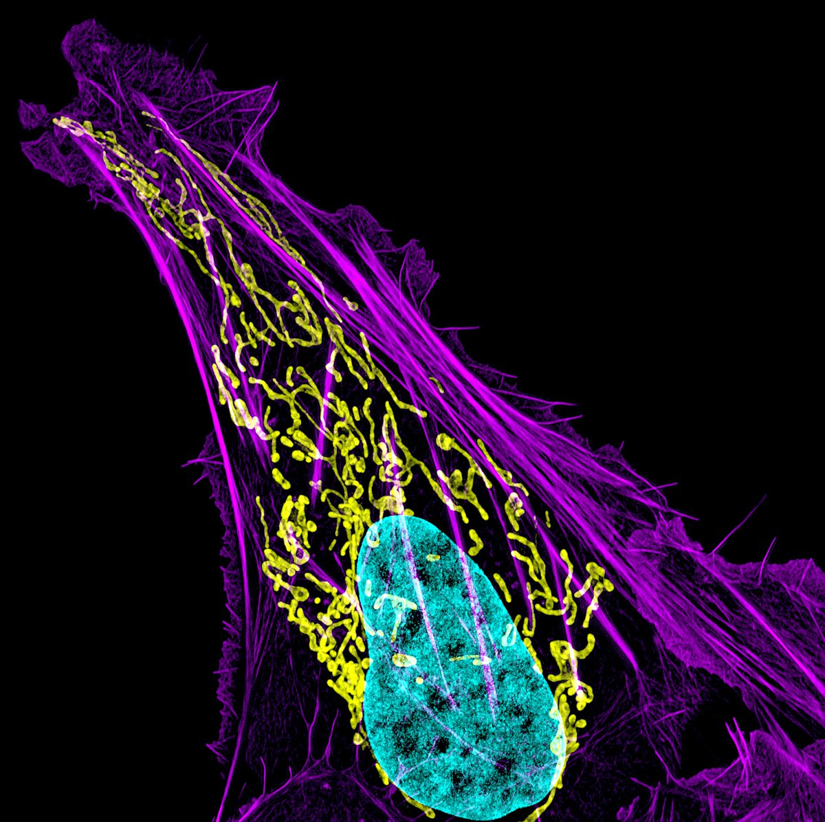 A cell photographed through a microscope. DNA in the nucleus (cyan), mitochondria (yellow), and actin filaments (magenta) are shown. #CellBiology