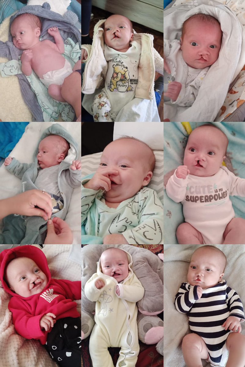 MARIUSBROODRYK's tweet photo. "Handmade blanket for only R50 per ticket. There are 100 tickets available, and once all tickets are sold, I will draw a winner. All funds will go to my grandson. Please send proof of payment privately to me.Cell no 0671786081 ; your name will be placed next to the number , and the draw will take place once all tickets are sold and paid for.

Bank:
JW Stassen
Nedbank
Account Number: 1184883254
Checking Account
Reference: Name and number.

1.
2.
3.
4.
5.
...
(Continue numbering until 100)"

Please note that I've left placeholders for the numbers from 1 to 100. You can fill in the ticket numbers accordingly.
Jarnus was born with a cleft lip and palate on June 18, 2023. He is almost four months old. We took him to Dr. Butow in Pretoria at Wilgers on October 4th. He needs his first surgery at five months and the second one at seven months, which is just around the corner.
@broodryk5 @Martina87553263 @SoulsHelp4