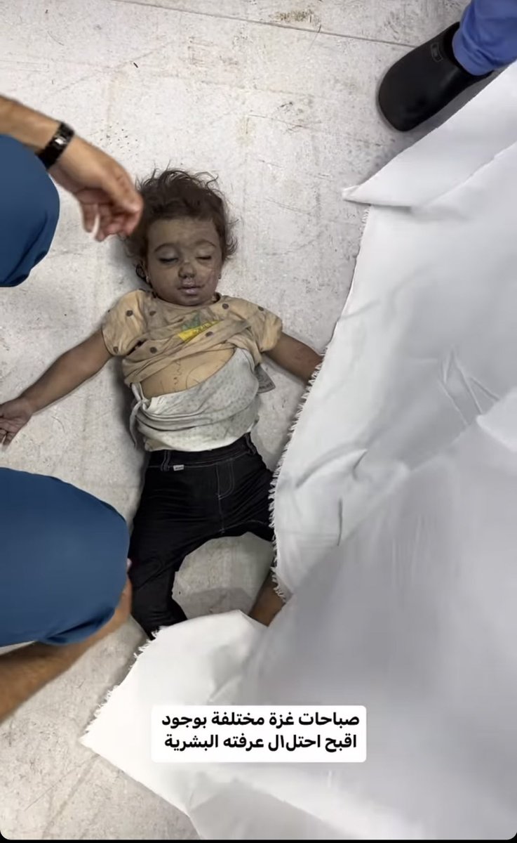 abhiraonly's tweet photo. صباحات غزة مختلفة بوجود أقبح احتل١ل عرفته البشرية
   #Ghaza #freepalaestine https://t.co/wpqPOlN2Hm