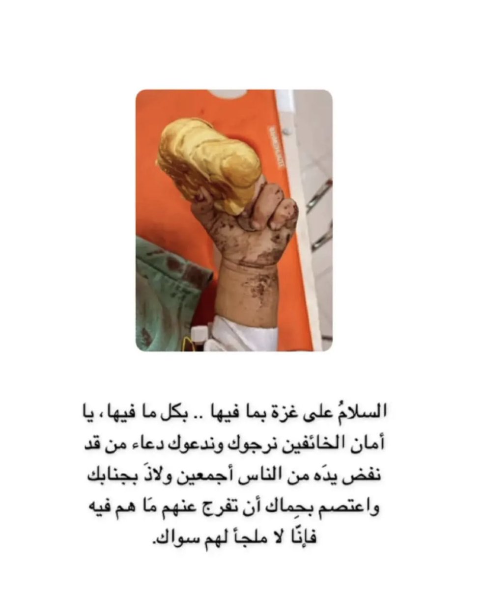 aareej586's tweet photo. #مستشفى_المعمداني #فلسطين_الان #غزة  #الاحتلال_الاسرائيلي https://t.co/BV1DGbqyZs