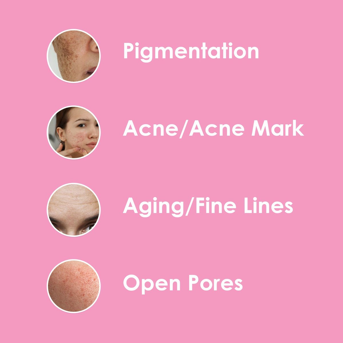 At Renisa Elegance Skin Clinic, we understand that every skin is unique. Whether it's pigmentation, acne marks, aging signs, open pores, dryness, or any other concern,

#RenisaElegance #SkinClinic #HairClinic #AdvancedSkincare #DeepCleansing #AcneScarTreatment #SkinRejuvenation