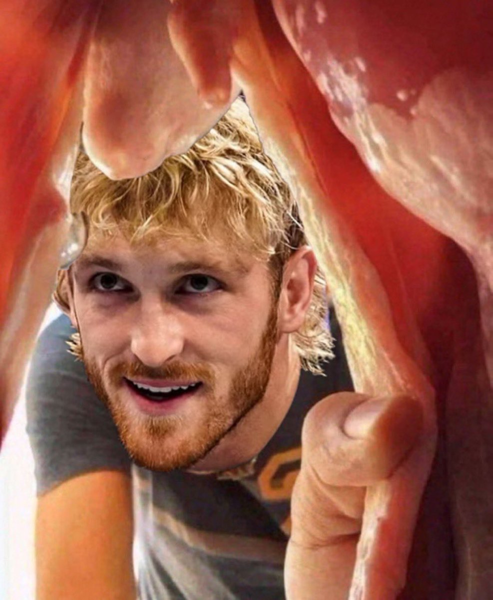 MYXEBUST tweet media