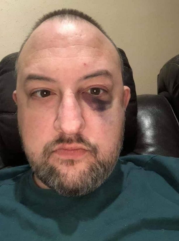 TweeetsOfDogs's tweet image. I had to repost this 🙏

“Thursday night, I was sitting in my garage smoking a cigarette. Horrible habit, I know. 4 young men rushed me, decided they wanted my car, beat me up, and wanted my keys. I told them the keys were in the house. They decided to go in. What they weren’t…