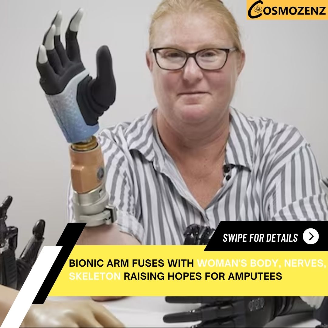 cosmozenz's tweet image. This marks the first time such long-term integration has been reported in a patient with a below-elbow amputation.

@cosmozenz

#bionichand #arms #viral #update #watch #dailytechnews #newsforyou #latestupdate #scienceandtechnology #explore #instadailynews #cosmozenz #Earth