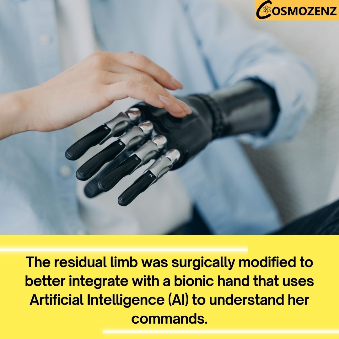 cosmozenz's tweet image. This marks the first time such long-term integration has been reported in a patient with a below-elbow amputation.

@cosmozenz

#bionichand #arms #viral #update #watch #dailytechnews #newsforyou #latestupdate #scienceandtechnology #explore #instadailynews #cosmozenz #Earth