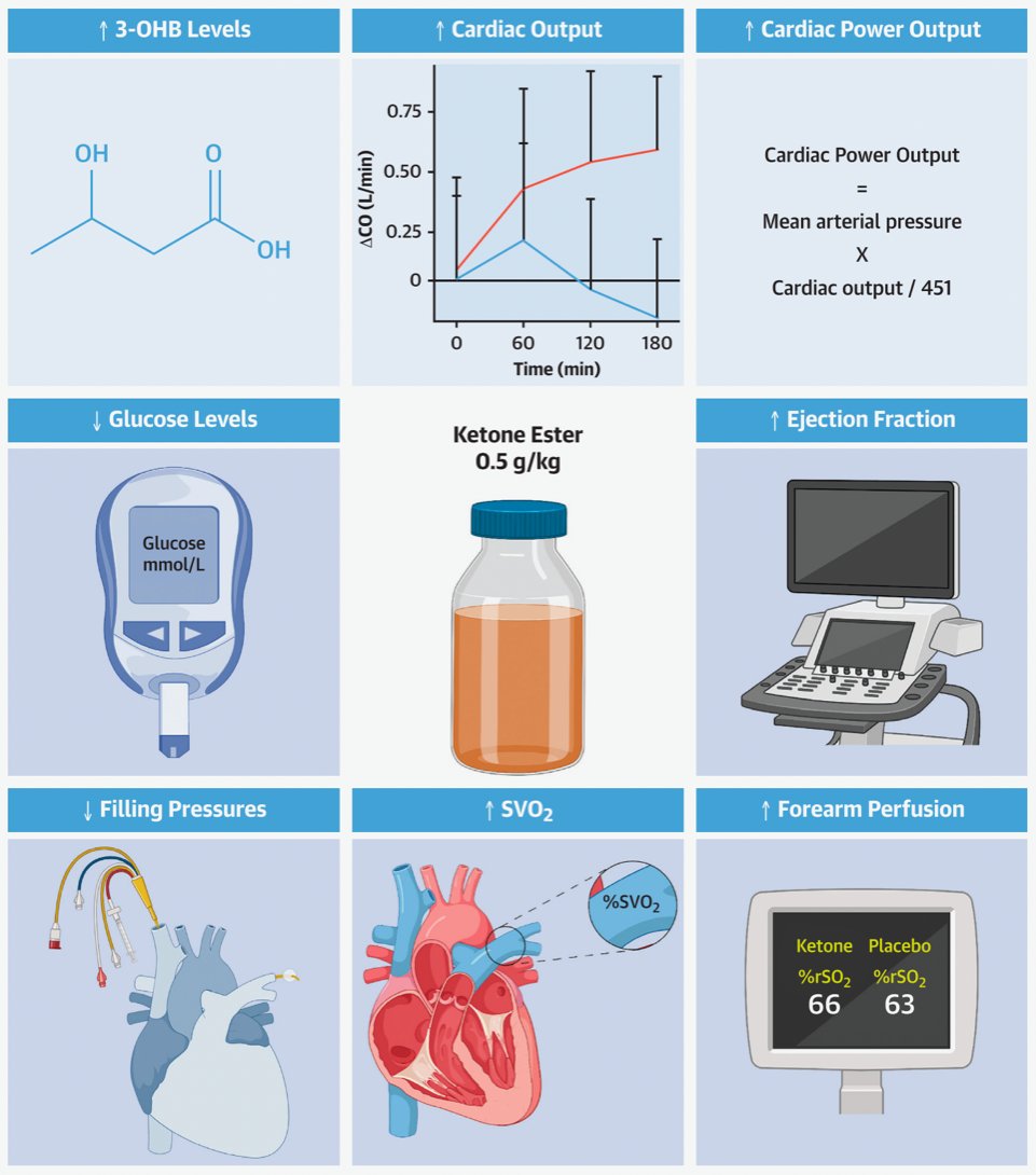Department of Cardiology Research AUH (@auhcardio) on Twitter photo 💎 New research!
🎓In <a href="/JACCJournals/">JACC Journals</a>, <a href="/KrisBergHansen/">Kristoffer Berg Hansen</a> et al demonstrated that treatment with #ketones improved hemodynamics in patients with #cardiogenicshock.
link: jacc.org/doi/10.1016/j.…
<a href="/GNigopan/">Nigopan Gopalasingam</a> <a href="/K_Hylleberg/">Kristian Christensen</a> <a href="/steffen_chr/">steffen christensen</a> #CardioTwitter 💎 New research!
🎓In <a href="/JACCJournals/">JACC Journals</a>, <a href="/KrisBergHansen/">Kristoffer Berg Hansen</a> et al demonstrated that treatment with #ketones improved hemodynamics in patients with #cardiogenicshock.
link: jacc.org/doi/10.1016/j.…
<a href="/GNigopan/">Nigopan Gopalasingam</a> <a href="/K_Hylleberg/">Kristian Christensen</a> <a href="/steffen_chr/">steffen christensen</a> #CardioTwitter