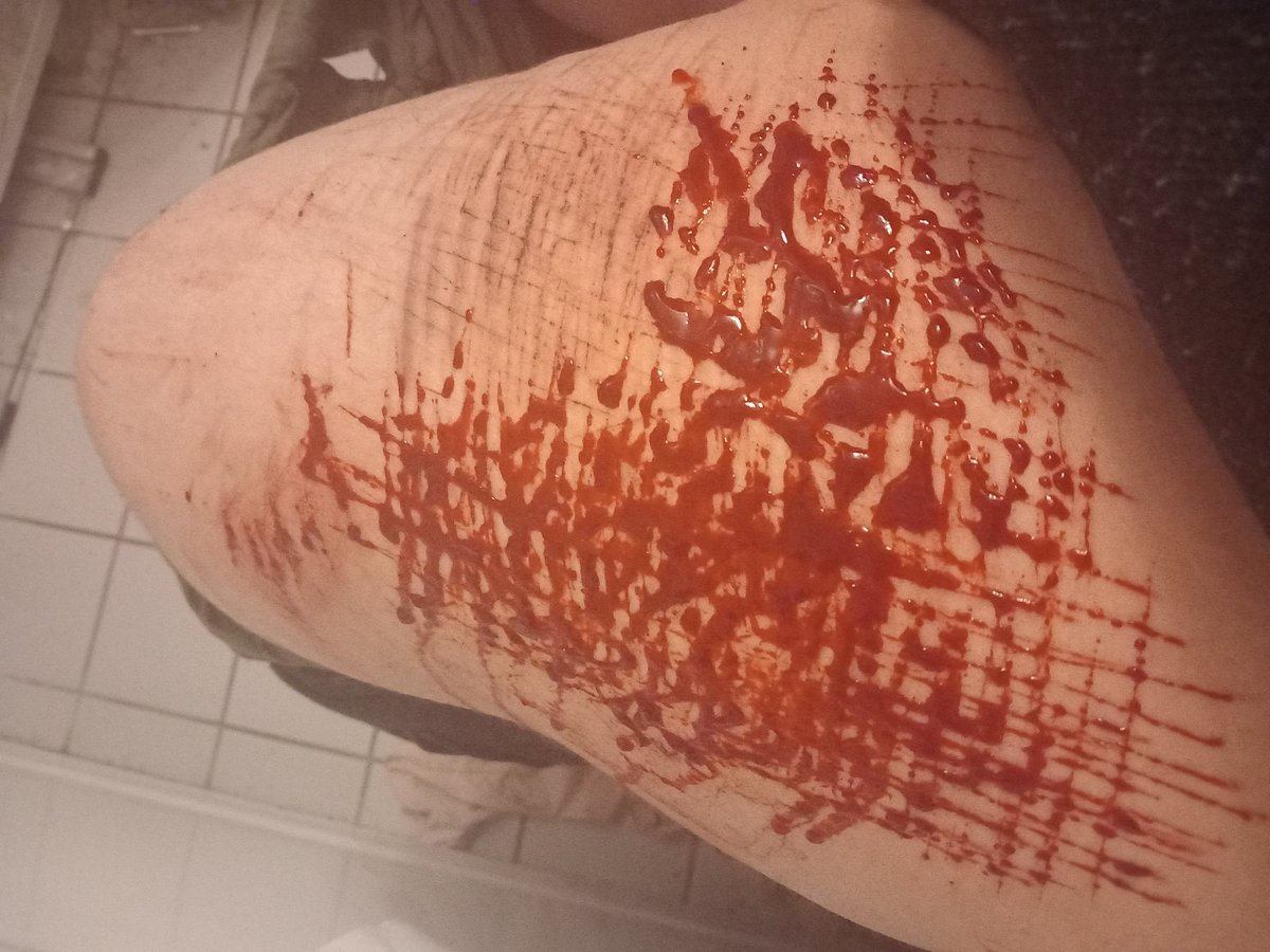 EdLeo241571's tweet photo. Halloween make up

Sh Twsh self Harm https://t.co/qOwSnhIEmU