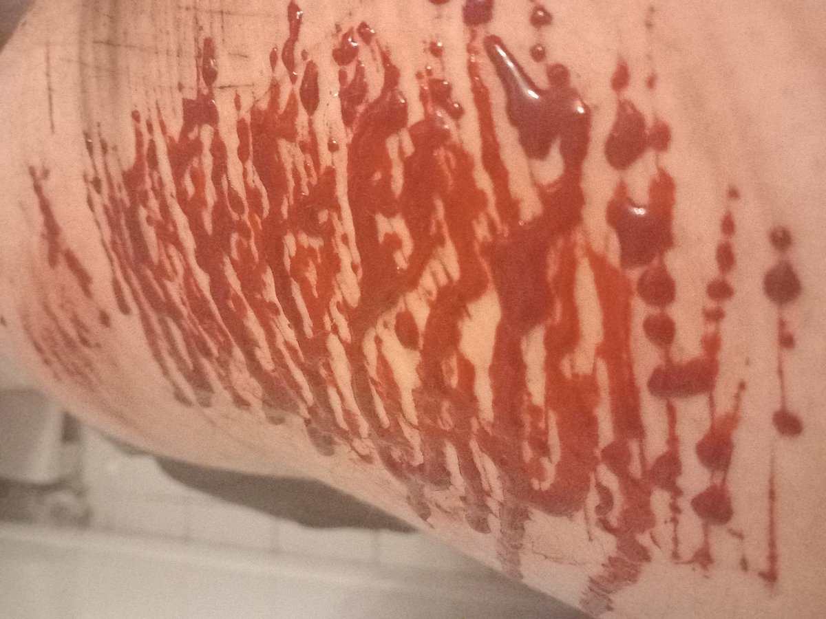 EdLeo241571's tweet photo. Halloween make up

Sh Twsh self Harm https://t.co/qOwSnhIEmU